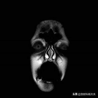 放射科趣味图片,放射科亮点图片