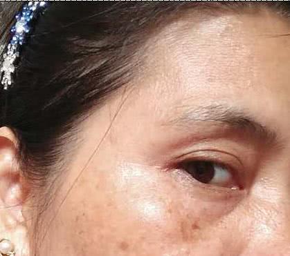 每天吃维C能祛斑？大错特错，真正能祛斑的是这3件事