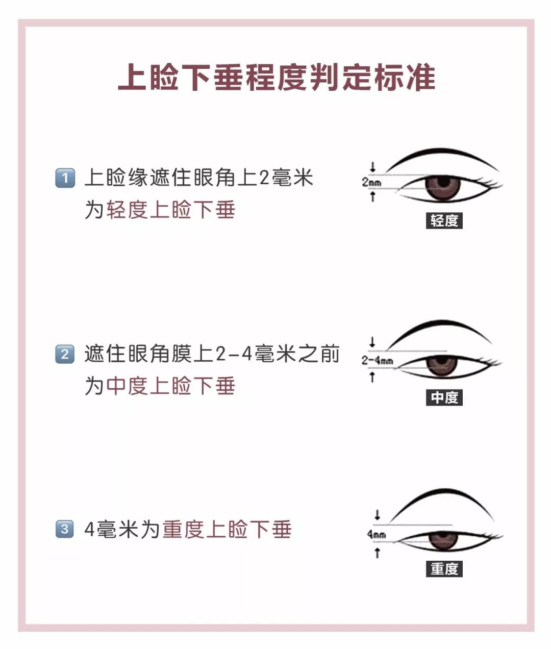 戚薇死鱼眼瞪人,戚薇死亡凝视