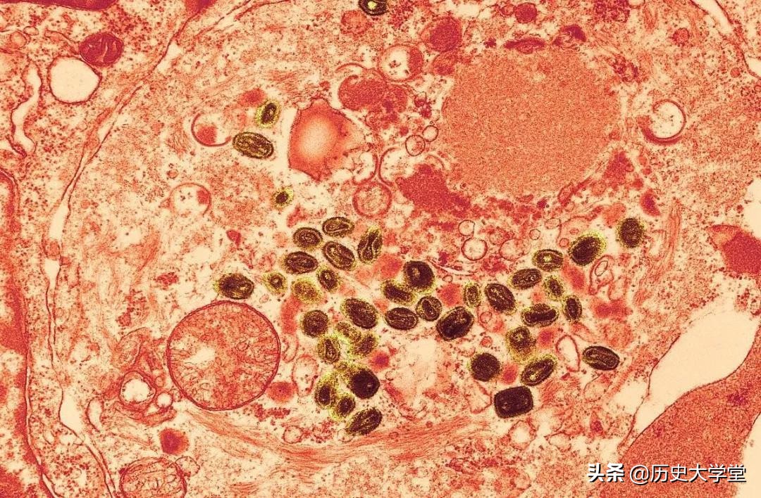在中国天花是怎么被解决的,历史上的天花是怎么消灭的