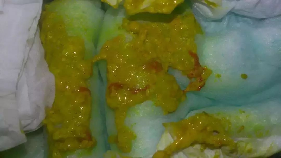 婴儿拉绿便的几种形状,宝宝拉绿便怎么鉴别