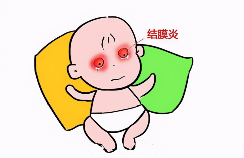 眼睛红了莫小视，因为结膜炎可能找上“门”