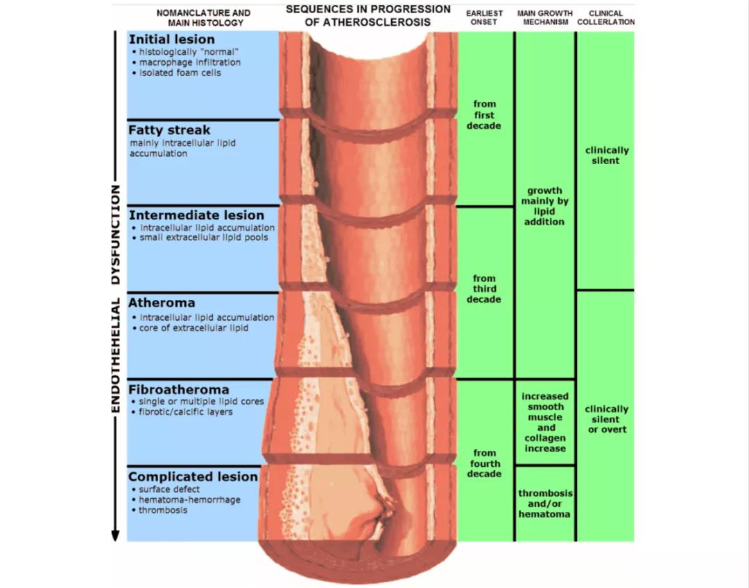 动脉粥样硬化靶向特效药,动脉粥样硬化最新药物研究