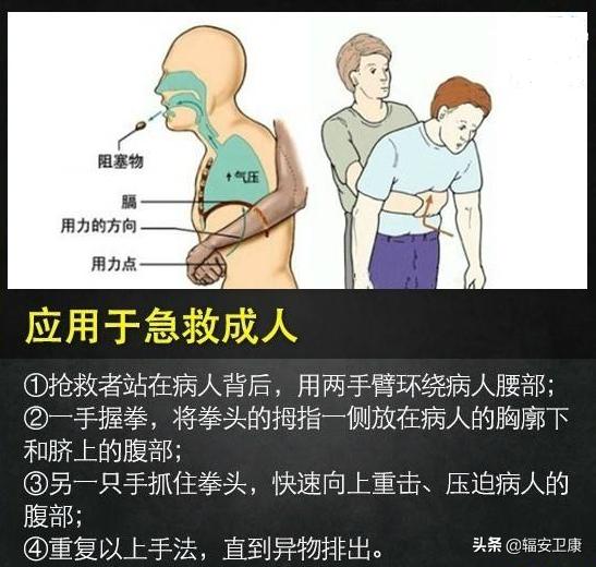 王宝强急救视频,海姆立克急救法王宝强视频