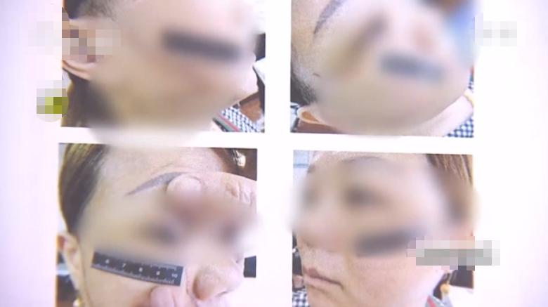 因与两个男人纠缠不清，上海女子被前男友划伤脸部致29厘米长伤疤！事后女子称：前男友真心爱我，会等他出来