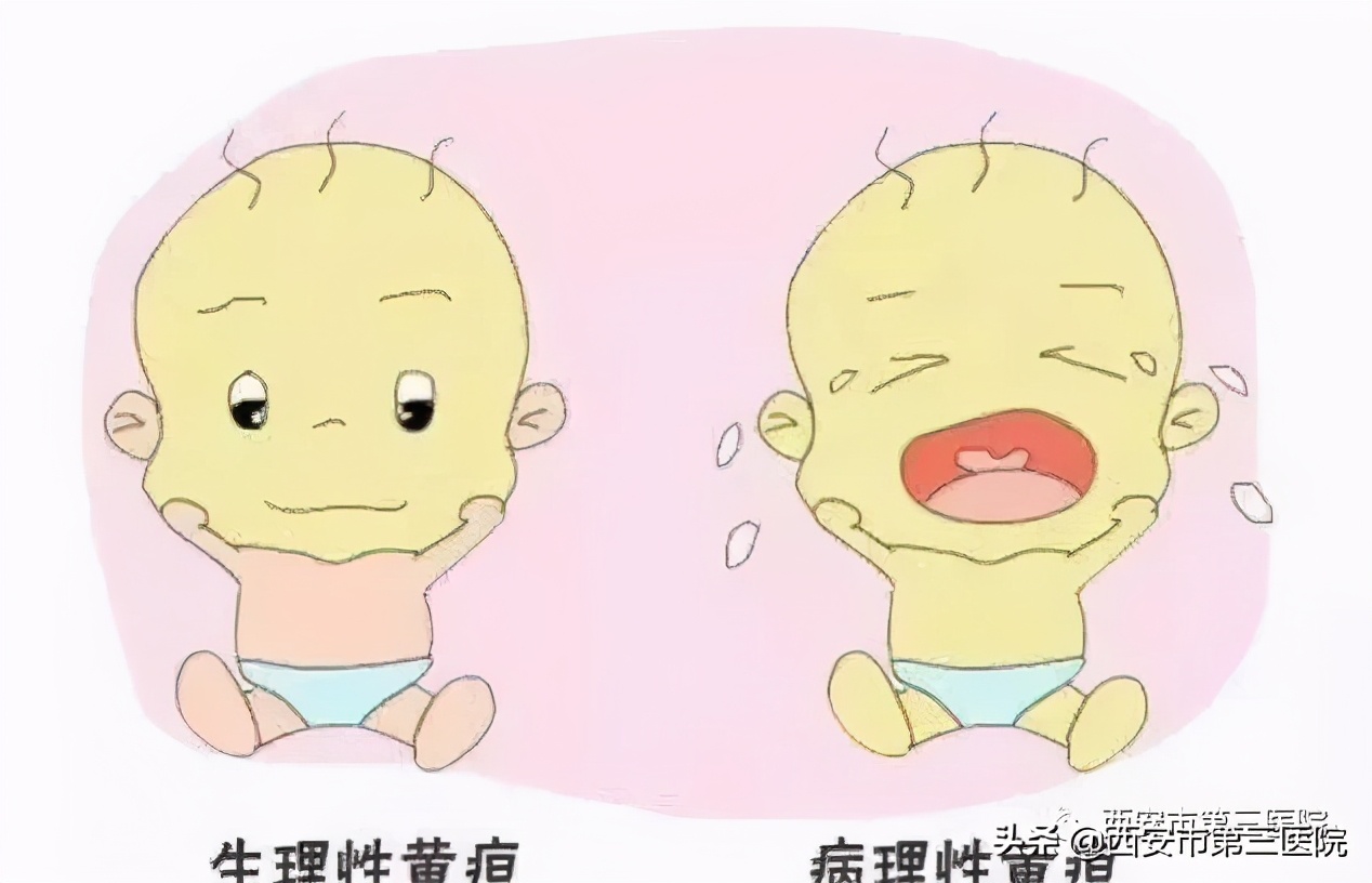 育儿须知宝宝出生有黄疸怎么办,担心宝宝出生有黄疸怎么办