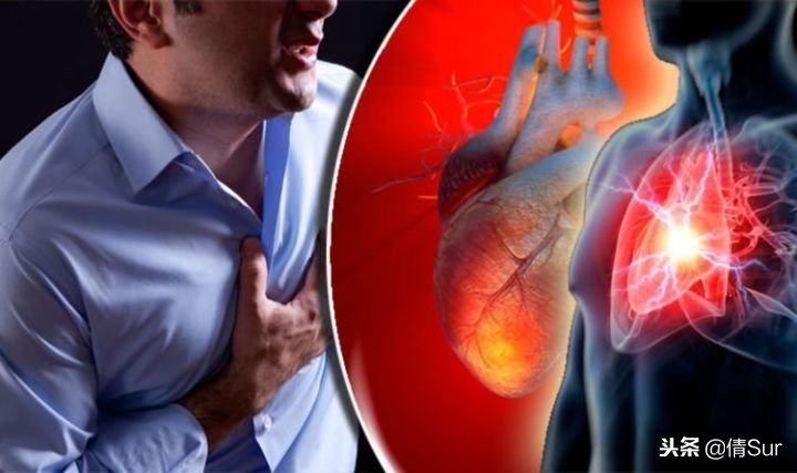 马拉松心梗猝死,马拉松心脏猝死的抢救