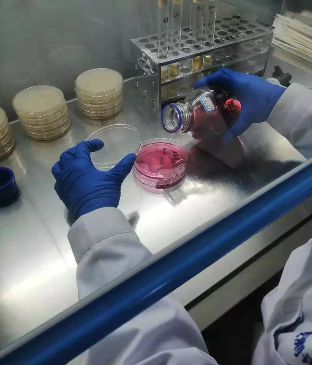 天天用的菜板，竟然有35万霉菌