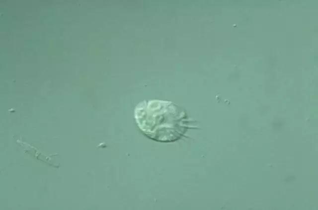 收藏!24种污水处理微生物菌相及指导意义,环保人必看(多图)