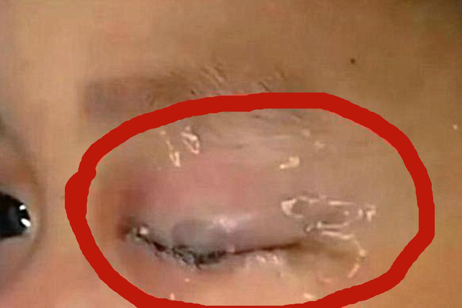 孩子误食了502强力胶,孩子误食了502强力胶吃什么药排毒