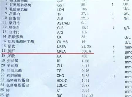 肌酐和痛风有什么关系,肌酐高痛风是如何引起的