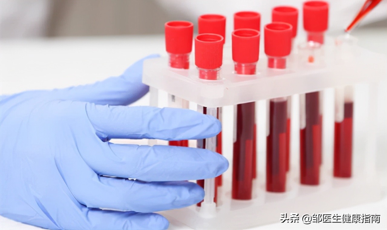 45岁绝经是不是太早了有什么不好,绝经太早或太晚都不是好事