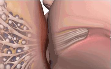 产后胀奶让老公吸？这是什么操作？