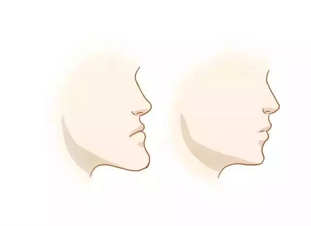 牙齿矫正全过程看完你就知道,目前几种常见的牙齿矫正方式