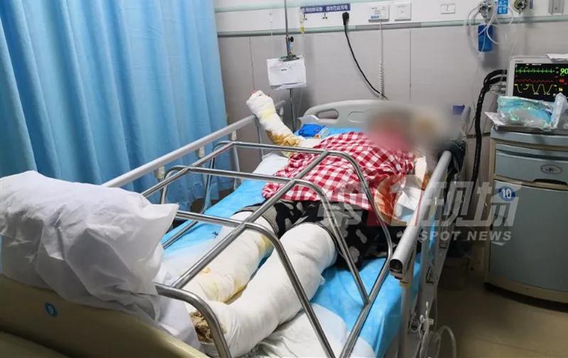 被雷击中怎么保命,女子家中突然被雷击中