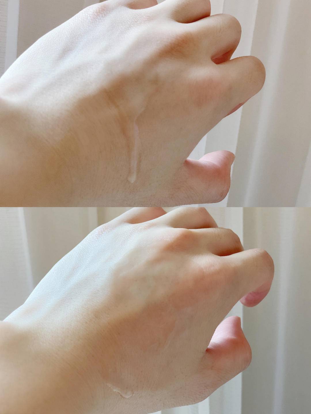 如何有效改善眼周水肿,眼水肿了怎么消肿