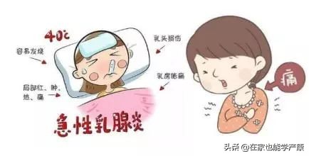 乳腺炎的预防和治疗方法。