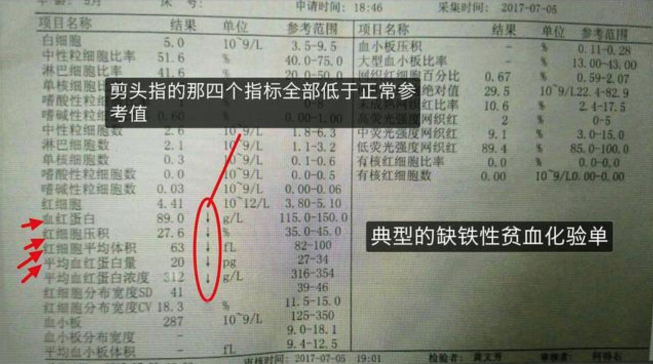 红糖怎么吃补血最快最有效,贫血喝红糖有效果吗