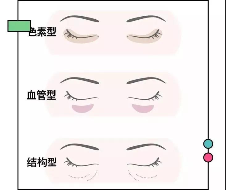 眼袋眼纹黑眼圈改善方法,去黑眼圈眼袋眼纹最有效的小妙招