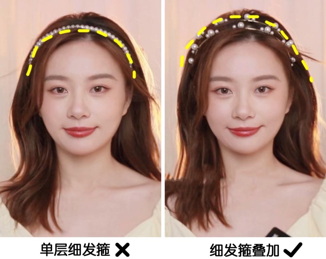 颅顶高了但发际线高怎么办,颅顶低的几种补救办法