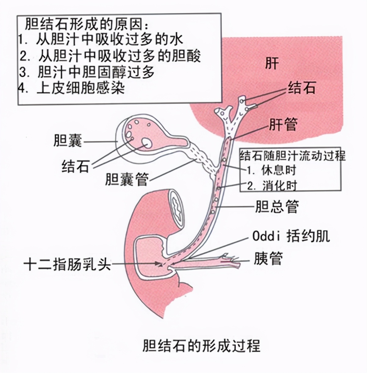胆囊炎为啥不能吃鸡蛋,胆囊炎能吃鸡蛋和鱼吗