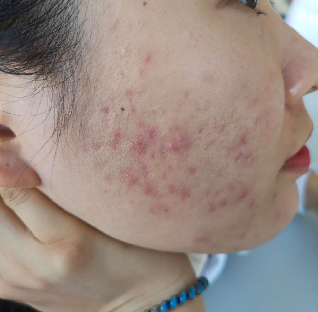 你的洗面奶上排名了吗,哪几种洗面奶上黑名单