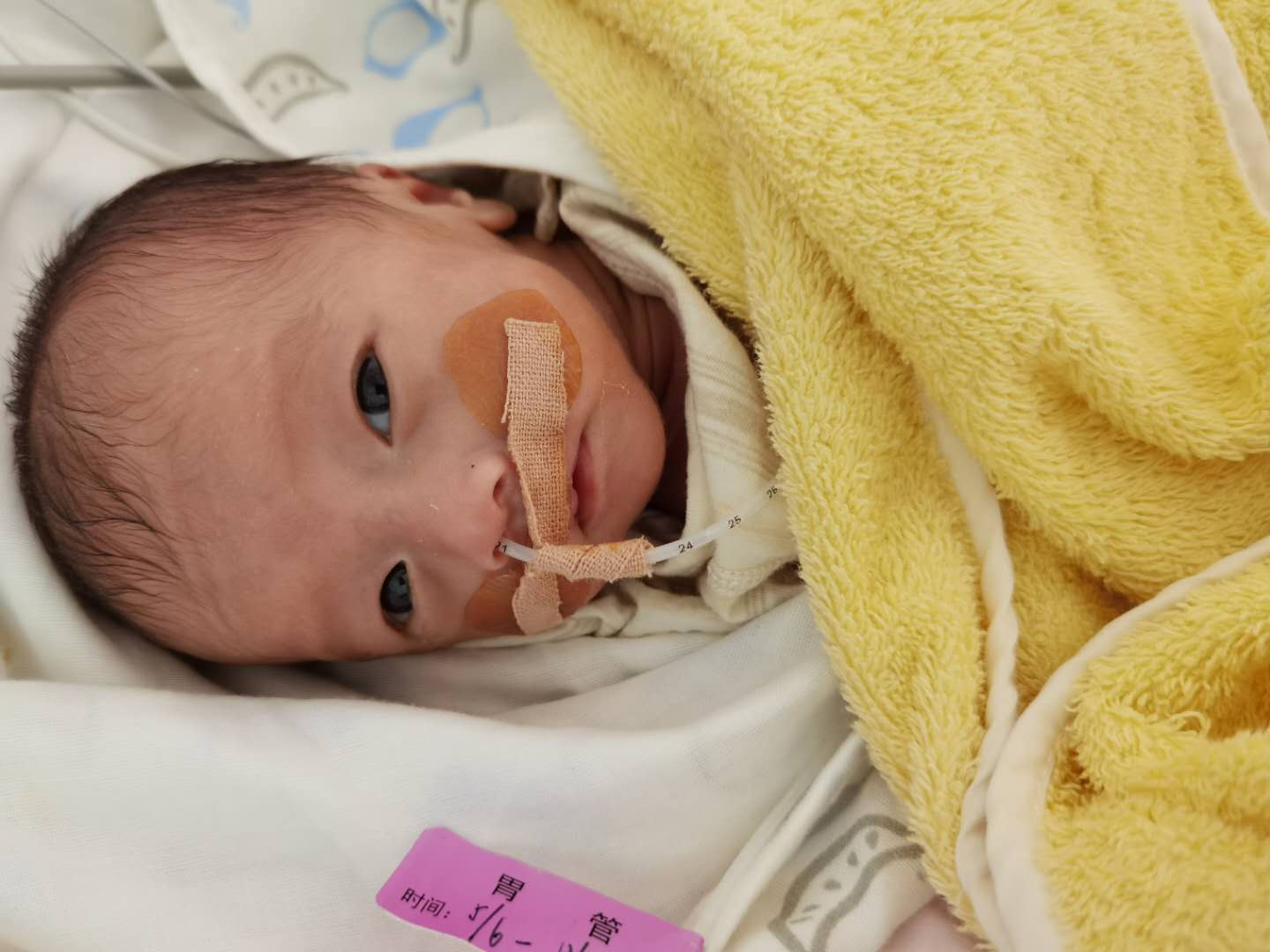 如何养育一个30周的早产儿,二十八周早产儿的养育