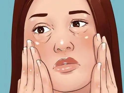 脸上浮肿与心脏有关吗,脸上长斑跟心脏有关系吗