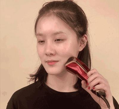 微整的真实效果,微整蜕变过程