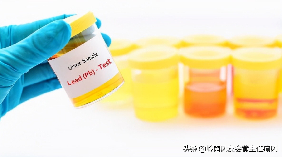 脚趾疼是痛风吗痛风都有什么症状,痛风是怎么引起的痛风有哪些症状