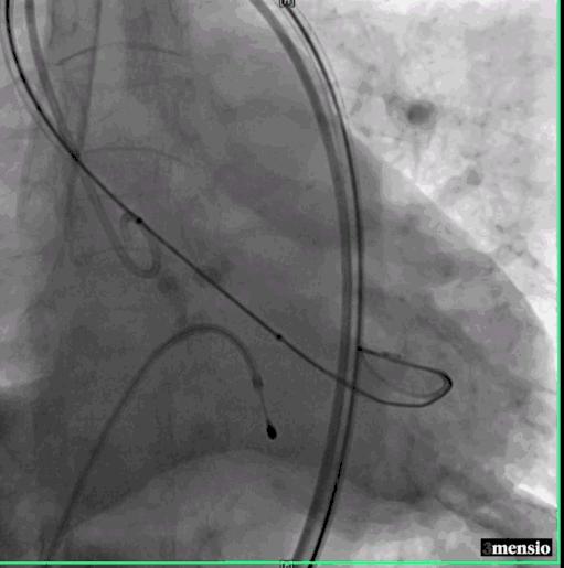 罗建方医生怎么样,罗建方教授