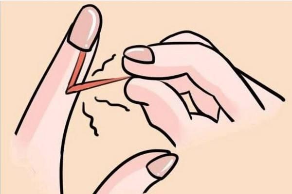 手指甲起倒刺缺维生素什么,手指甲倒刺缺维生素
