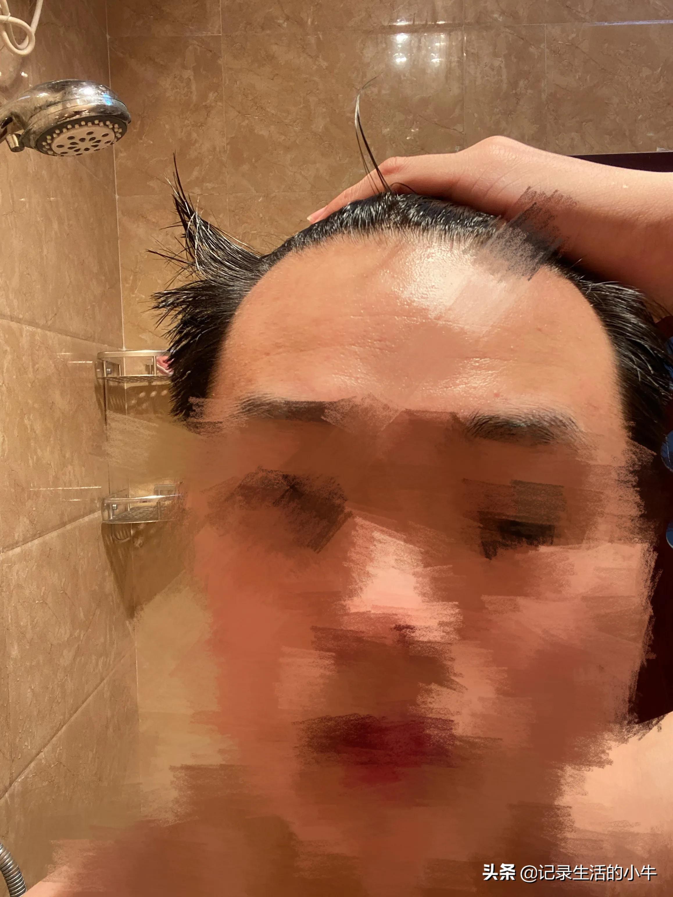 小米生发仪是真的吗,小米有品生发梳