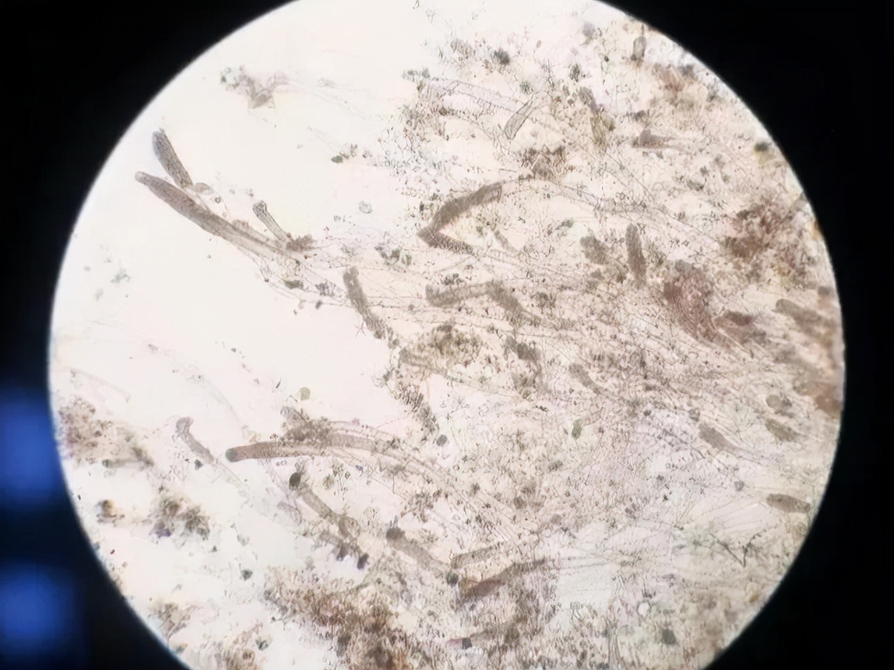 养殖池塘水霉怎么治疗,真菌感染水泡怎么治才能除根