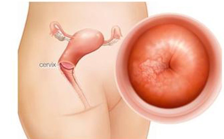 子宫息肉怀孕要紧吗,有子宫息肉怀孕的几率