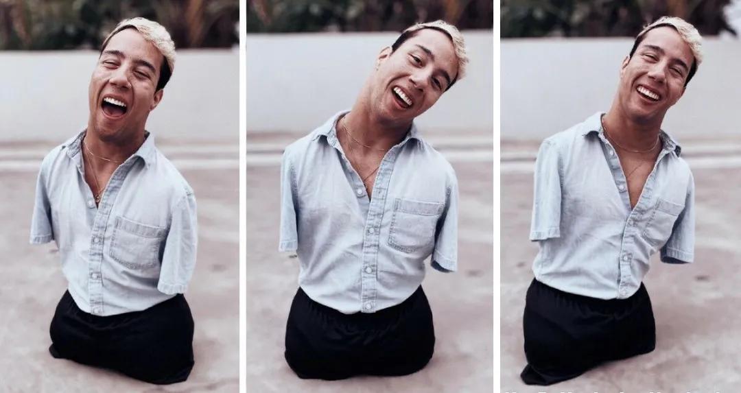 美国男子没手没脚,美国先天没有四肢的男孩