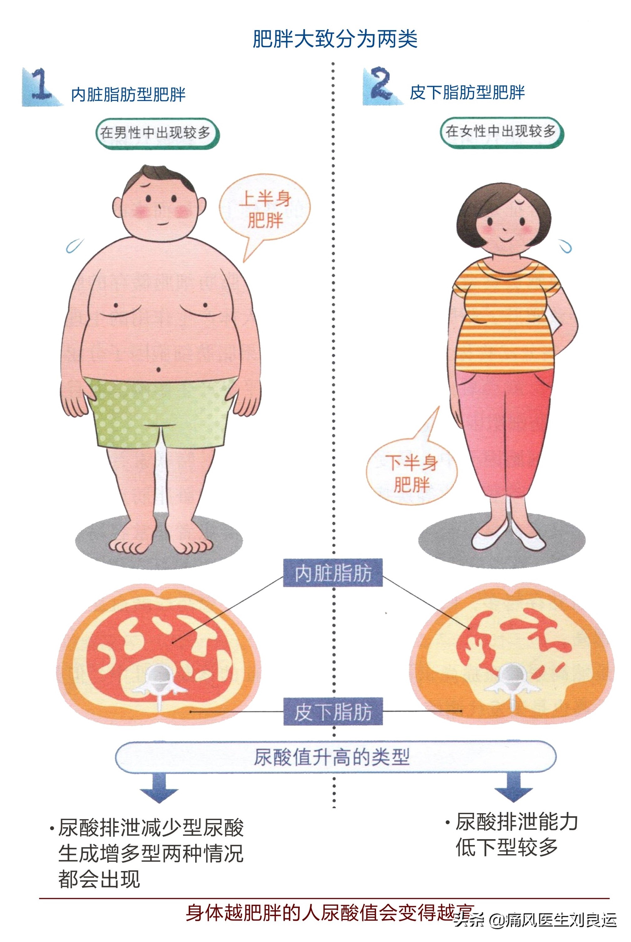 快速降尿酸治痛风的处方,痛风降尿酸中药靠谱吗