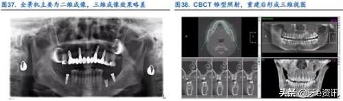 为何说“金眼银牙”？口腔中的“高富帅”有哪些？