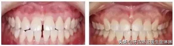 诺尔口腔牙齿矫正怎么样,淄博诺尔漫口腔