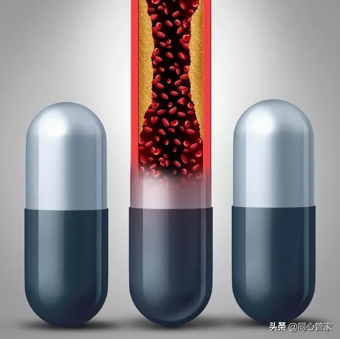 血管狭窄如何扼住生命的咽喉？让你全身器官都遭殃？