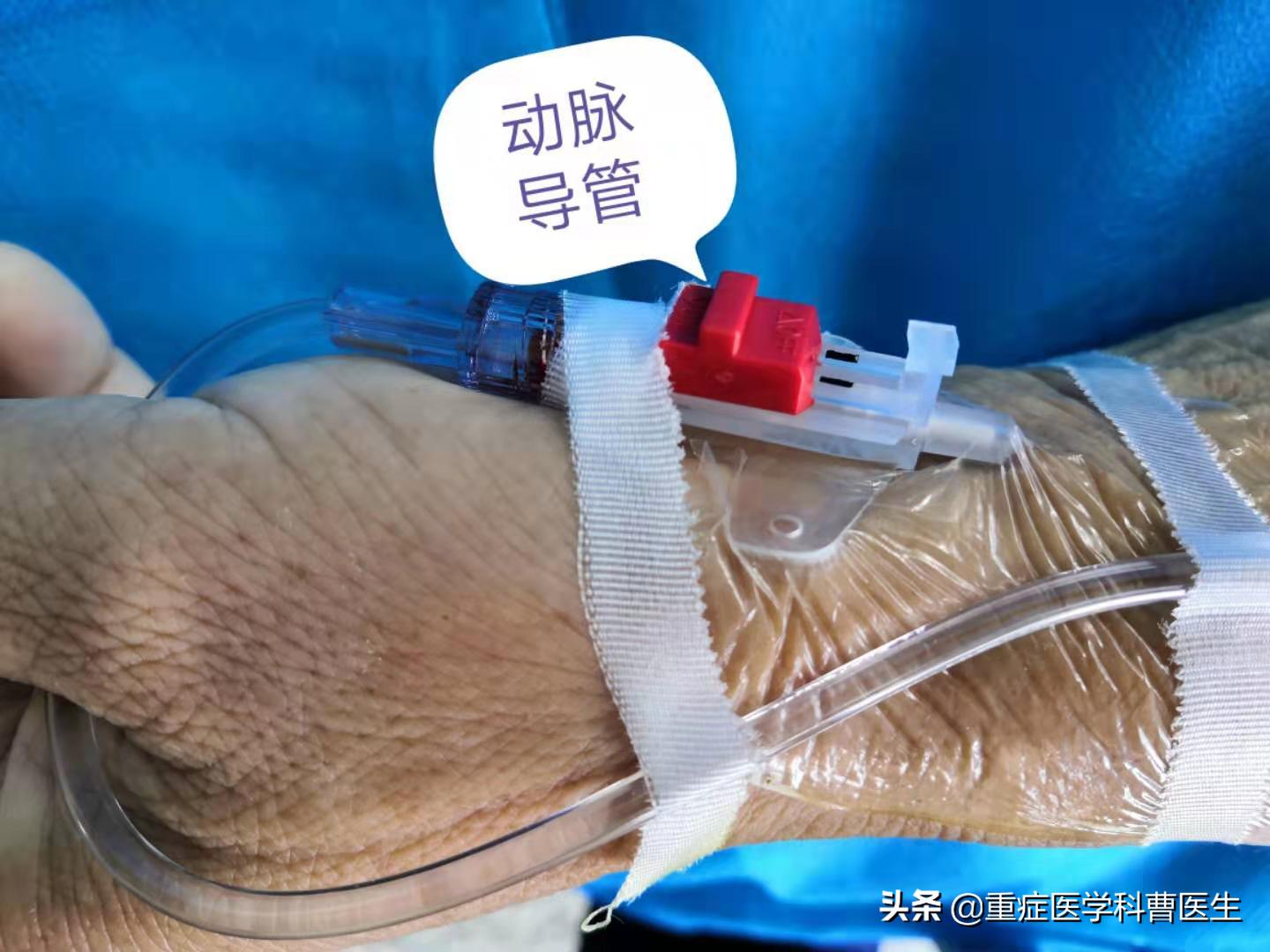 降压药不能擅自停服,降压药吃了不能吃啥