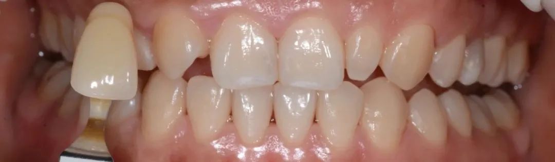 口腔牙医感言,牙医从业感悟