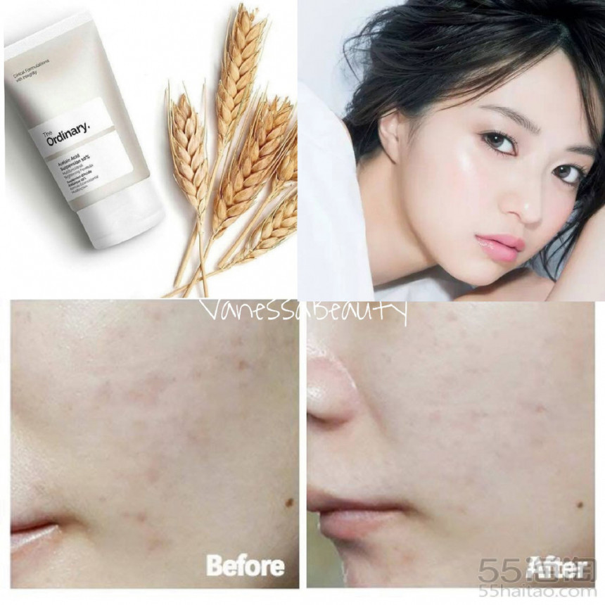 「5姐种草」平价“猛药”THEORDINARY有哪些口碑产品值得入手