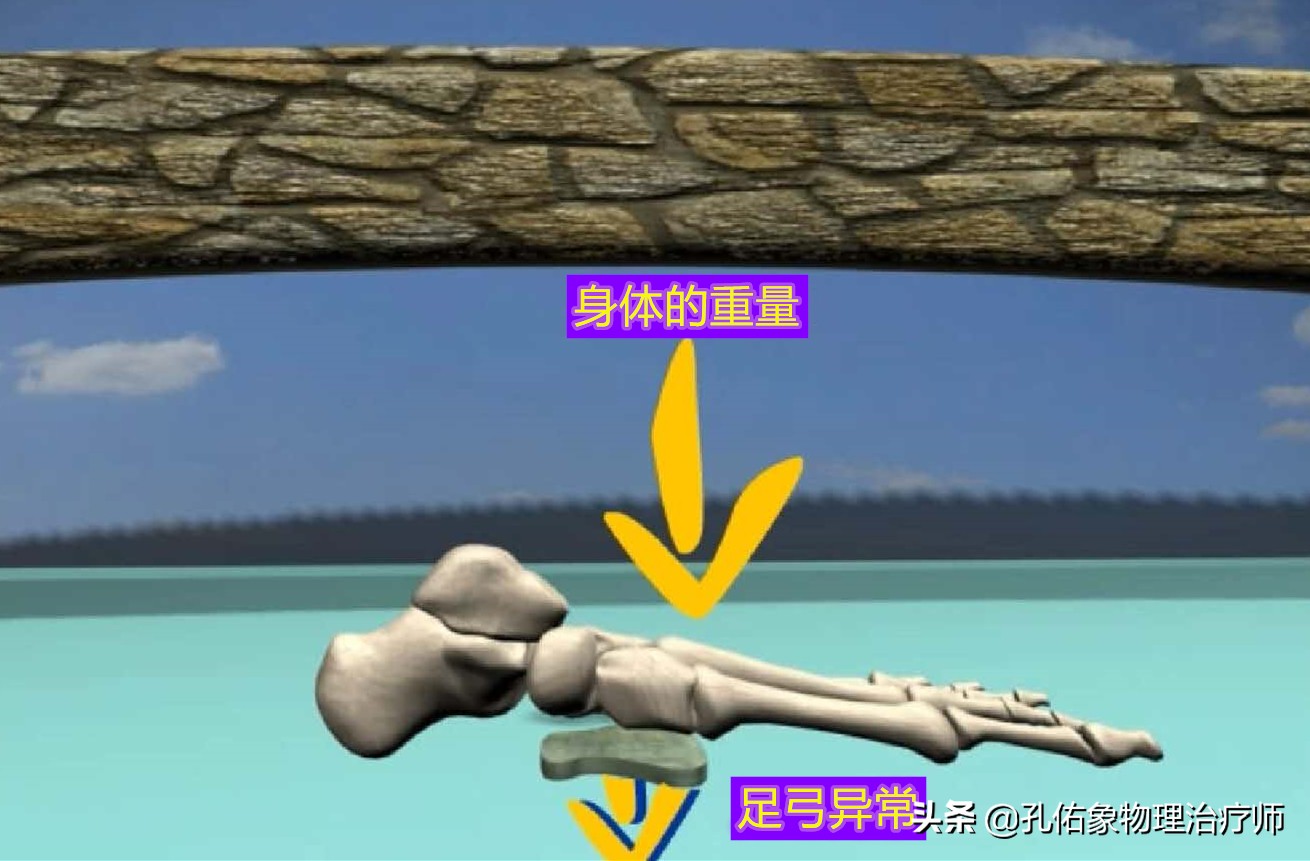 足底筋膜炎痛怎么治疗,足跟痛足底筋膜炎怎么治疗