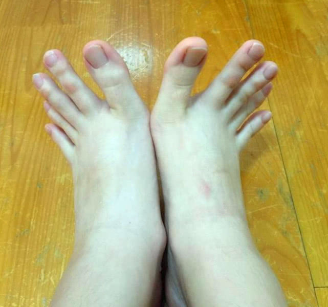 大拇脚趾长俗语怎么说,二脚趾比大脚趾长代表不孝顺吗