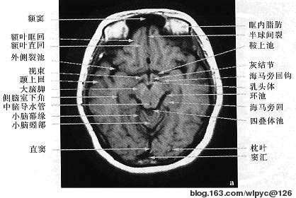 医生常用的解剖学、内外科口诀