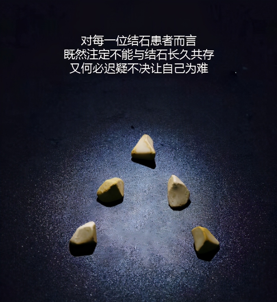 有胆结石要不要割,有胆结石要把胆囊全部切除吗