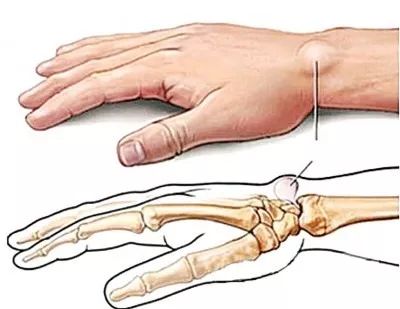 一分钟看懂癌症风险,十大必知的癌症冷知识