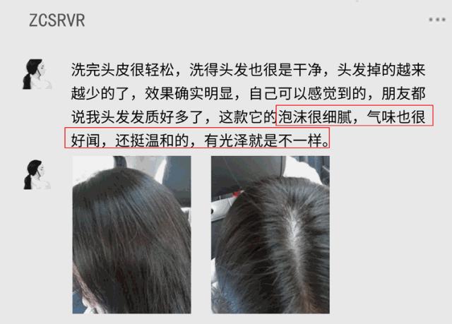 沙宣洗发水掉头发,沙宣洗发水洗了脱发