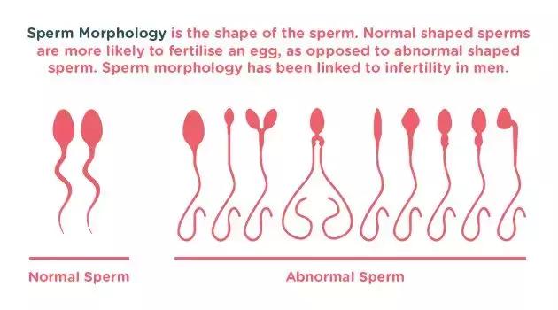 原来一颗卵子和精子谈恋爱,需要千万颗精子当备胎!